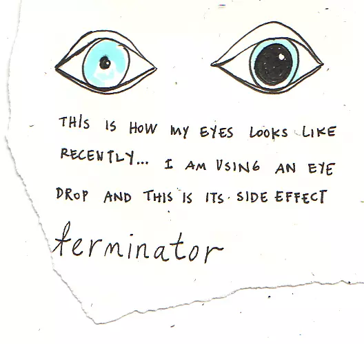 This is how my eyes looks like recently... I am using an eye drop and this is its side effect terminator